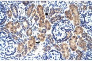 Rabbit Anti-MYCBP Antibody Catalog Number: ARP31860 Paraffin Embedded Tissue: Human Kidney Cellular Data: Epithelial cells of renal tubule Antibody Concentration: 4. (MYCBP antibody  (Middle Region))