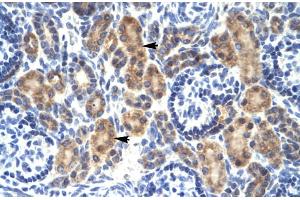 Rabbit Anti-MYCBP Antibody Catalog Number: ARP31860 Paraffin Embedded Tissue: Human Kidney Cellular Data: Epithelial cells of renal tubule Antibody Concentration: 4. (MYCBP antibody  (Middle Region))