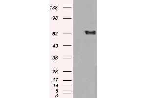 HEK293 overexpressing EHD2 and probed with ABIN2562378 (mock transfection in first lane). (EHD2 antibody  (C-Term))