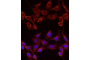 Immunofluorescence analysis of NIH-3T3 using Cortactin antibody (ABIN6127722, ABIN6139243, ABIN6139244 and ABIN6221478) at dilution of 1:25 (40x lens). (Cortactin antibody  (AA 214-513))