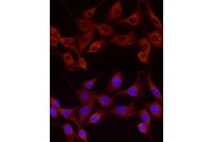Immunofluorescence analysis of NIH-3T3 using Cortactin antibody (ABIN6127722, ABIN6139243, ABIN6139244 and ABIN6221478) at dilution of 1:25 (40x lens). (Cortactin antibody  (AA 214-513))