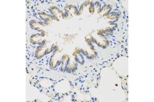 Immunohistochemistry of paraffin-embedded rat lung using TICAM1 antibody. (TICAM1 antibody  (AA 20-200))