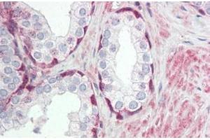 Human Prostate: Formalin-Fixed, Paraffin-Embedded (FFPE) (TRIM59 antibody  (Internal Region))