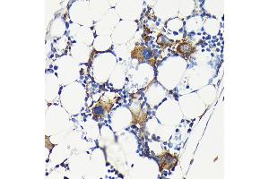 Immunohistochemistry (IHC) image for anti-Integrin beta 3 (ITGB3) (AA 610-718) antibody (ABIN6142584)