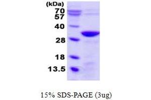 SDS-PAGE (SDS) image for Unc-119 Homolog B (UNC119B) (AA 1-251) protein (His tag) (ABIN5780452) (UNC119B Protein (AA 1-251) (His tag))
