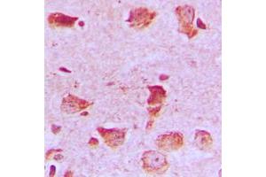 Immunohistochemical analysis of NDUFA8 staining in human brain formalin fixed paraffin embedded tissue section. (NDUFA8 antibody  (Center))