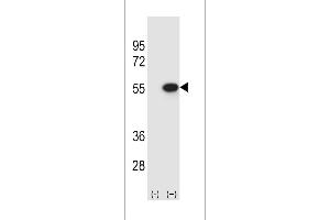 Western blot analysis of RUVBL2 using rabbit polyclonal RUVBL2 Antibody using 293 cell lysates (2 ug/lane) either nontransfected (Lane 1) or transiently transfected (Lane 2) with the RUVBL2 gene. (Reptin,TIP49B,RUVB2 (AA 400-430), (C-Term) antibody)