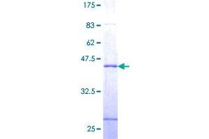 SSNA1 Protein (AA 1-119) (GST tag)