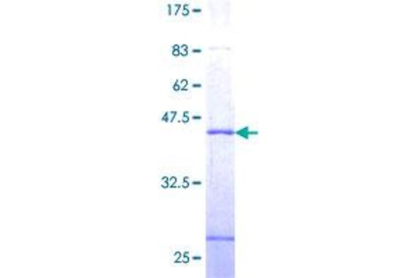 SSNA1 Protein (AA 1-119) (GST tag)