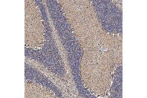 IHC analysis of SFXN5 using anti-SFXN5 antibody (ABIN7601388). (Sideroflexin 5 antibody  (AA 34-340))