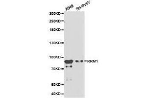 Western Blotting (WB) image for anti-Ribonucleotide Reductase M1 (RRM1) antibody (ABIN1874668) (RRM1 antibody)