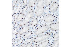 Immunohistochemistry of paraffin-embedded mouse kidney using Phospho-c-Jun-T91 Rabbit pAb (ABIN7268058) at dilution of 1:50 (40x lens). (C-JUN antibody  (pThr91))