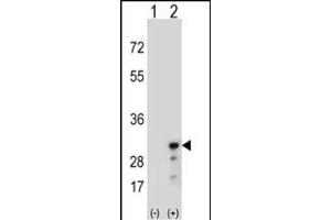 Western blot analysis of PRDX3 (arrow) using rabbit polyclonal PRDX3 Antibody (N-term) (ABIN389470 and ABIN2839534).