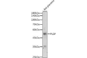 Western blot analysis of extracts of Rat placenta, using PLGF antibody (ABIN7269385) at 1:500 dilution. (PLGF antibody)