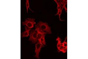 ABIN6266990 staining LOVO by IF/ICC. (FAP antibody  (Internal Region))