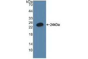 Western blot analysis of recombinant Human GADD45a.