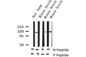 Western blot analysis of Phospho-PKCD (Tyr64) expression in various lysates (PKC delta antibody  (pTyr64))