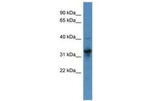 Image no. 1 for anti-T Brachyury Protein (N-Term) antibody (ABIN6746059)