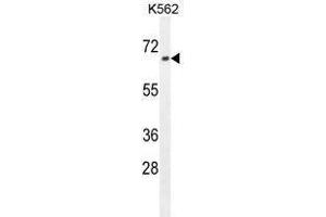 ZN169 Antibody (N-term) western blot analysis in K562 cell line lysates (35 µg/lane). (ZNF169 antibody  (N-Term))