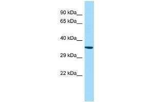 WB Suggested Anti-GPR160 Antibody Titration: 1. (GPR160 antibody  (N-Term))