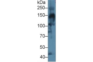 Detection of COL4a3 in Mouse Skeletal muscle lysate using Polyclonal Antibody to Collagen Type IV Alpha 3 (COL4a3) (COL4a3 antibody  (AA 1428-1670))