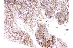 IHC analysis of LCP1 using anti-LCP1 antibody (ABIN6719421). (LCP1 antibody)