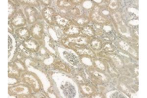 ABIN6255413 and ABIN6267124 at 1/100 staining human normal kidney tissue by IHC-P. (LIPE antibody  (pSer563, pSer853))