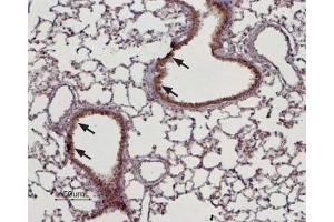 Expression of TRPM4 in rat lung - Immunohistochemical staining of rat lung paraffin embedded sections using Anti-TRPM4 Antibody (ABIN7043833, ABIN7044008 and ABIN7044009), (1:100). (TRPM4 antibody  (Intracellular))