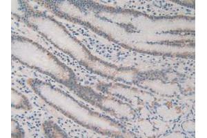 IHC-P analysis of Human Stomach Tissue, with DAB staining. (ACAT2 antibody  (AA 1-397))