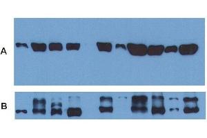 Use of anti-alpha-tubulin antibody as a loading control (A) in an Western blotting experiment revealing the staining pattern ofvarious cell lysates by a newly developed monoclonal antibody (B). (alpha Tubulin antibody  (FITC))
