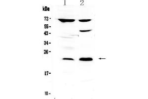 Western blot analysis of TRFP / MED20 using anti-TRFP / MED20 antibody . (MED20 antibody  (AA 1-212))