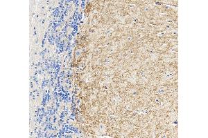 IHC analysis of CHRM1 using anti-CHRM1 antibody (ABIN7602749). (CHRM1 antibody  (C-Term))