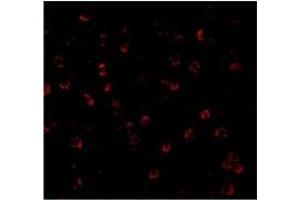 Immunofluorescence of ATG7 in MCF7 cells with ATG7 Antibody at 20 µg/ml. (ATG7 antibody  (C-Term))