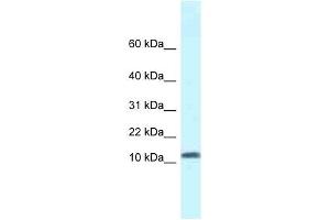 Western Blot showing SSBP1 antibody used at a concentration of 1 ug/ml against Fetal Kidney Lysate (SSBP1 antibody  (N-Term))