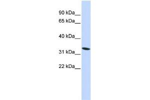 WB Suggested Anti-HMG20A Antibody Titration: 0. (HMG20A antibody  (N-Term))