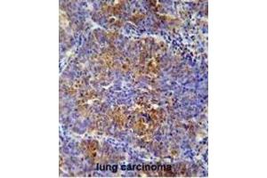 Immunohistochemistry (IHC) image for anti-Activating Transcription Factor 7 Interacting Protein 2 (ATF7IP2) antibody (ABIN2995682)