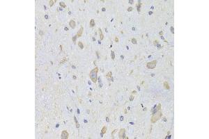 Immunohistochemistry of paraffin-embedded rat spinal cord using EEF1B2 Antibody. (EEF1B2 antibody  (AA 1-225))