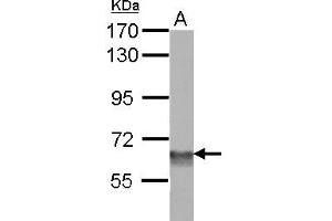 Western Blotting (WB) image for anti-SWI/SNF Related, Matrix Associated, Actin Dependent Regulator of Chromatin, Subfamily D, Member 3 (SMARCD3) (AA 105-441) antibody (ABIN1501913) (SMARCD3 antibody  (AA 105-441))