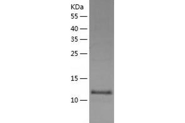 FABP12 Protein (AA 1-140) (His tag)