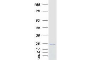 Validation with Western Blot