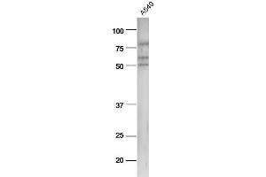 A549 cell lysates probed with Anti-pan-Cytokeratin Polyclonal Antibody, Unconjugated  at 1:5000 90min in 37˚C. (Cytokeratin 1 antibody  (AA 101-200))