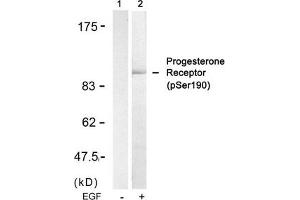 Western blot analysis of extracts from SKOV3 cells untreated(lane 1) or treated with EGF(lane 2) using Progesterone Receptor(Phospho-Ser190) Antibody. (Progesterone Receptor antibody  (pSer190))