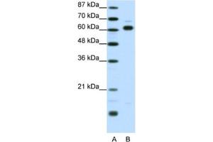 Western Blotting (WB) image for anti-Thyroid Hormone Receptor Interactor 4 (TRIP4) antibody (ABIN2461241) (TRIP4 antibody)