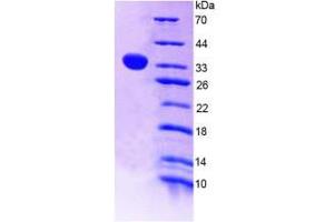SDS-PAGE (SDS) image for Angiopoietin-Like 4 (ANGPTL4) (AA 182-394) protein (His tag) (ABIN1169872)