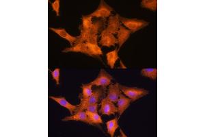 Immunofluorescence analysis of C6 cells using ALDOC Rabbit pAb (ABIN6129897, ABIN6136788, ABIN6136789 and ABIN6215308) at dilution of 1:100. (ALDOC antibody  (AA 1-170))