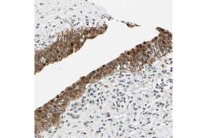 Immunohistochemical staining (Formalin-fixed paraffin-embedded sections) of human urinary bladder with MINA polyclonal antibody  shows strong nuclear and cytoplasmic positivity in urothelial cells. (MINA antibody)