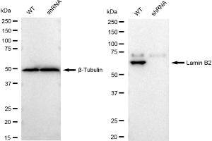Western blotting analysis using Lamin B2 antibody (ABIN7799233). (Recombinant Lamin B2 antibody)