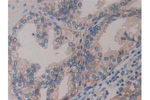 Detection of MCP in Human Prostate Tissue using Polyclonal Antibody to Membrane Cofactor Protein (MCP) (CD46 antibody  (AA 147-285))