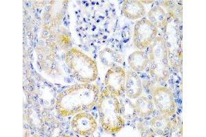 Immunohistochemistry of paraffin-embedded Rat kidney using UPF2 Polyclonal Antibody at dilution of 1:200 (40x lens). (RENT2/UPF2 antibody)