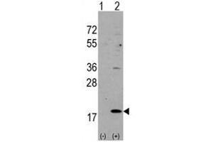 Image no. 3 for anti-Hippocalcin-Like 1 (HPCAL1) (N-Term) antibody (ABIN357110) (HPCAL1 antibody  (N-Term))